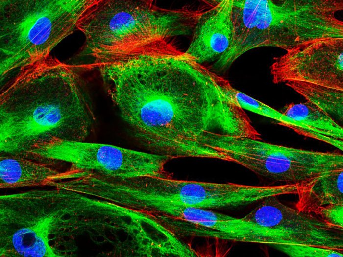 AOTF在共聚焦显微镜中的应用和优势