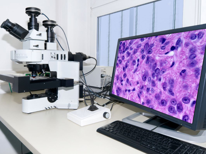 共聚焦显微镜，又称共聚焦激光扫描显微镜（CLSM）